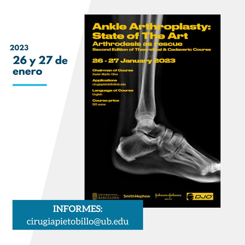 Ankle Arthroscopy: state of the art